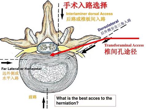 兩穴同入